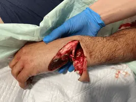 1642078352544.webp 1642078352544.webp