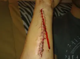 20112009416.webp 20112009416.webp