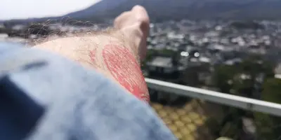 IMG_20200321_131835.webp IMG_20200321_131835.webp