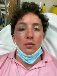 el-pequeno-nicolas-acaba-hospitalizado-tras-un-incidente-con-un-vigilante-en-marbella.webp el-pequeno-nicolas-acaba-hospitalizado-tras-un-incidente-con-un-vigilante-en-marbella.webp