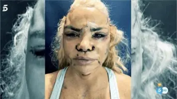 el-nuevo-rostro-de-leticia-sabater-y-el-dineral-que-se-ha-gastado.webp