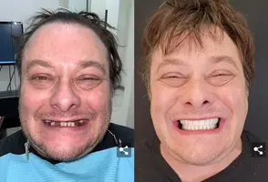 Edward-Furlong-dientes.webp