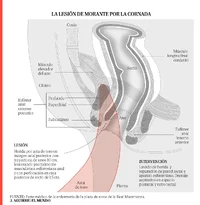 Screenshot_20260423_071902_Free Adblocker Browser.webp