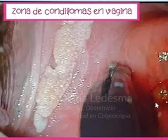 1791665304478.webp