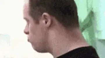 downy-down-syndrome (1).webp
