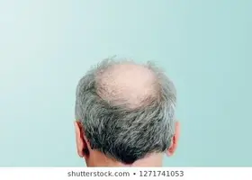 rear-view-male-head-without-260nw-1271741053.webp