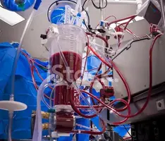 10413110-heart-lung-machine-for-extracorporeal-circulation.webp