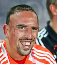 franck-ribery-images-teeth.jpg