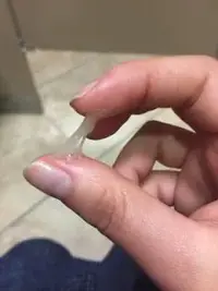 flujo vaginal.webp