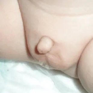 MicroMcpenis
